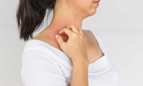 Psoriasis Treatment For Skin in Dubai, Abu Dhabi, Bahrain - UAE